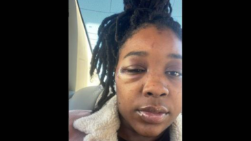 Kansas City Woman Alleges Police Brutality: Called 'Animal' During Arrest