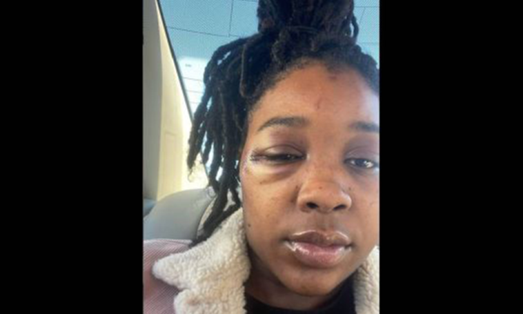 Kansas City Woman Alleges Police Brutality: Called 'Animal' During Arrest