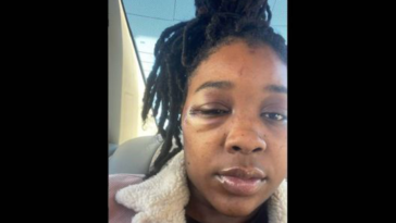 Activists Criticize KCPD After Brutal Arrest